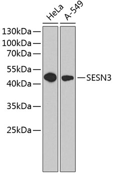 Anti-SESN3 Antibody