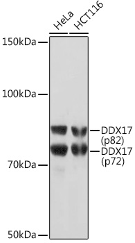 Anti-DDX17 Antibody [ARC1413]