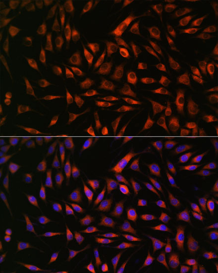Anti-EML4 Antibody Anti-EML4 Antibody