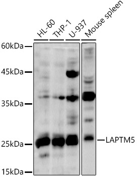 Anti-LAPTM5 Antibody