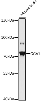 Anti-GGA1 Antibody