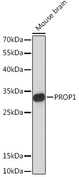 Anti-PROP1 Antibody