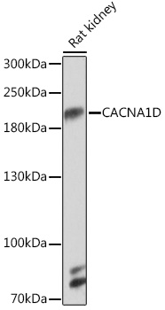 Anti-CaV1.3 Antibody