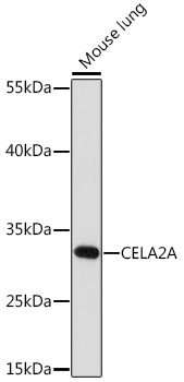 Anti-CELA2A Antibody
