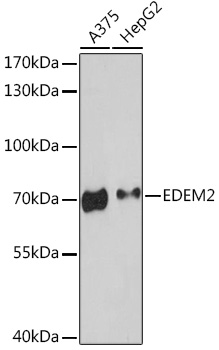Anti-EDEM2 Antibody