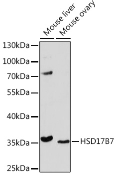 Anti-HSD17B7 Antibody