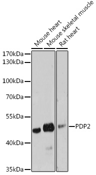 Anti-PDP2 Antibody