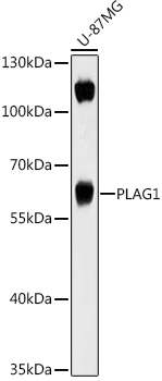 Anti-PLAG1 Antibody
