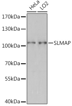 Anti-SLMAP Antibody