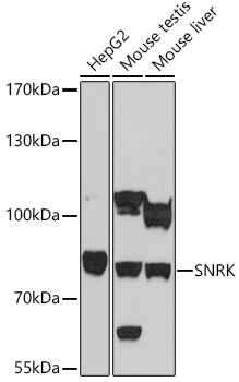 Anti-SNRK Antibody