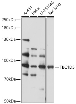 Anti-TBC1D5 Antibody