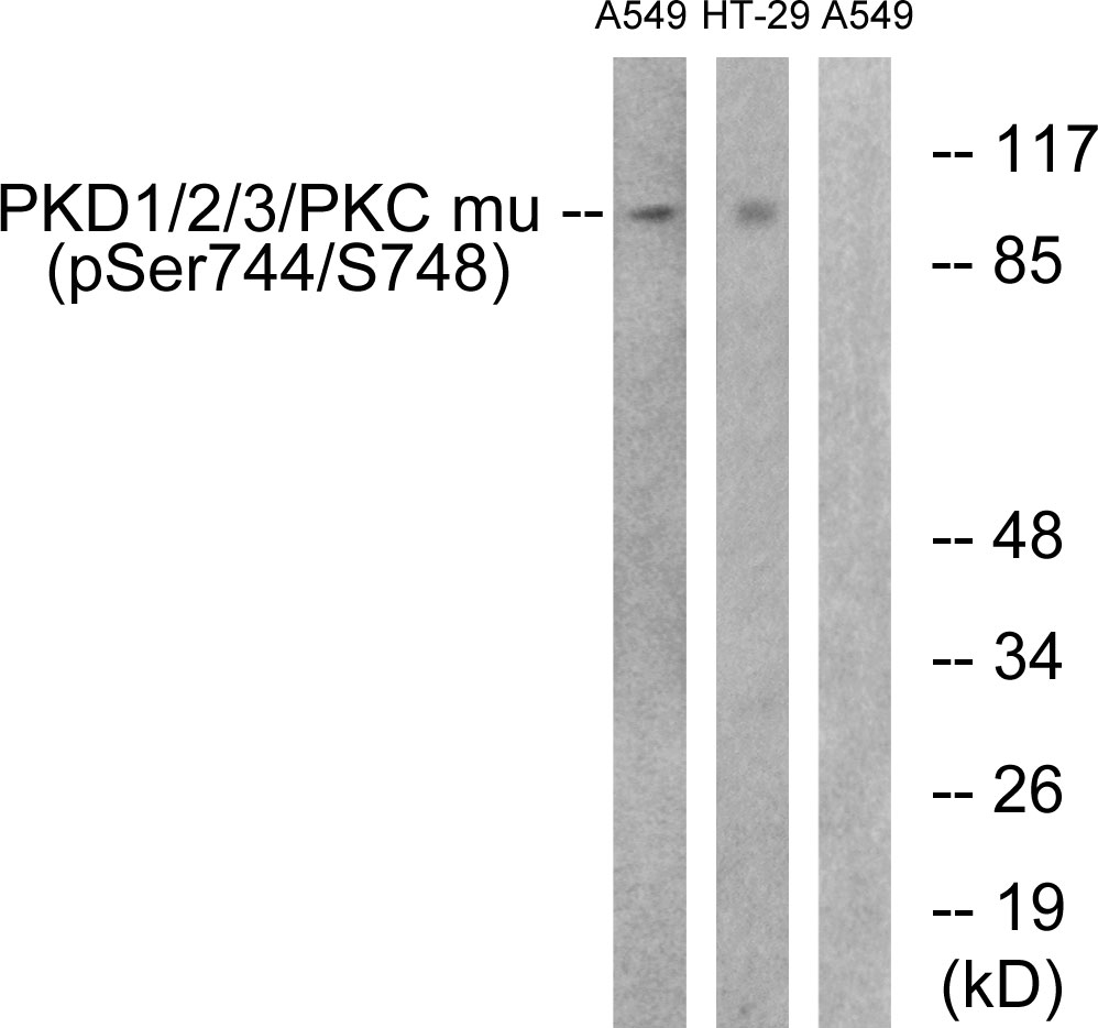Anti-PKD1 + PKD2 + PKD3 (phospho Ser738 + Ser742) Antibody