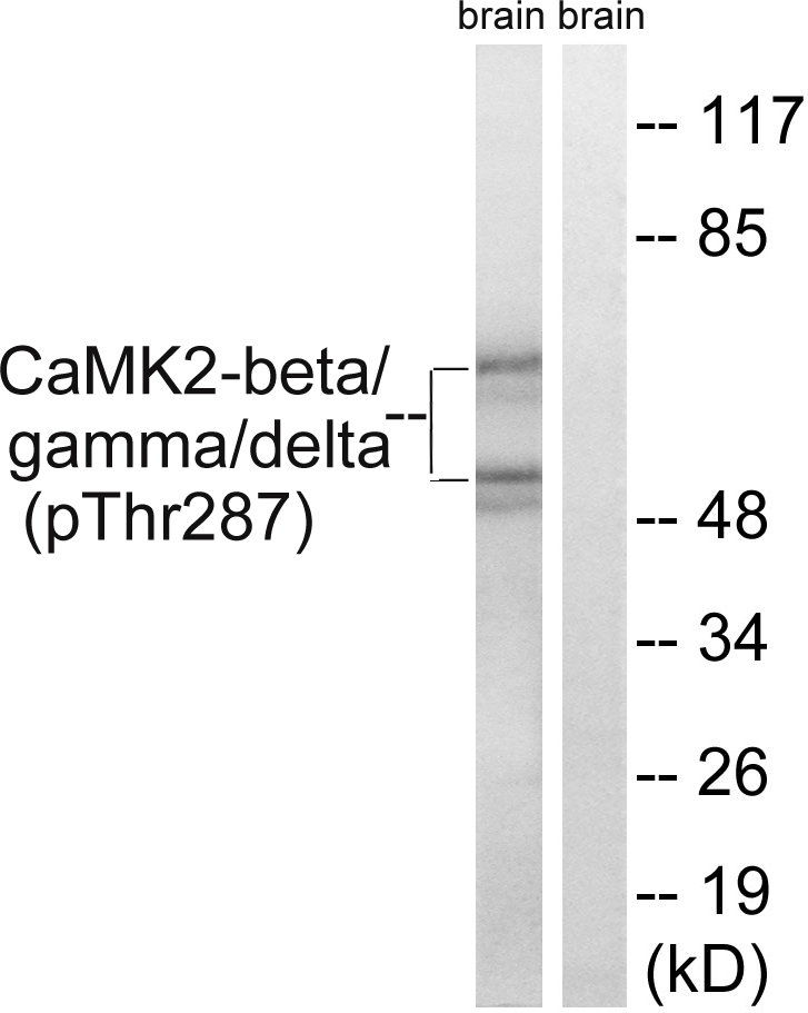Anti-CaMK2 beta + gamma + delta (phospho Thr287) Antibody