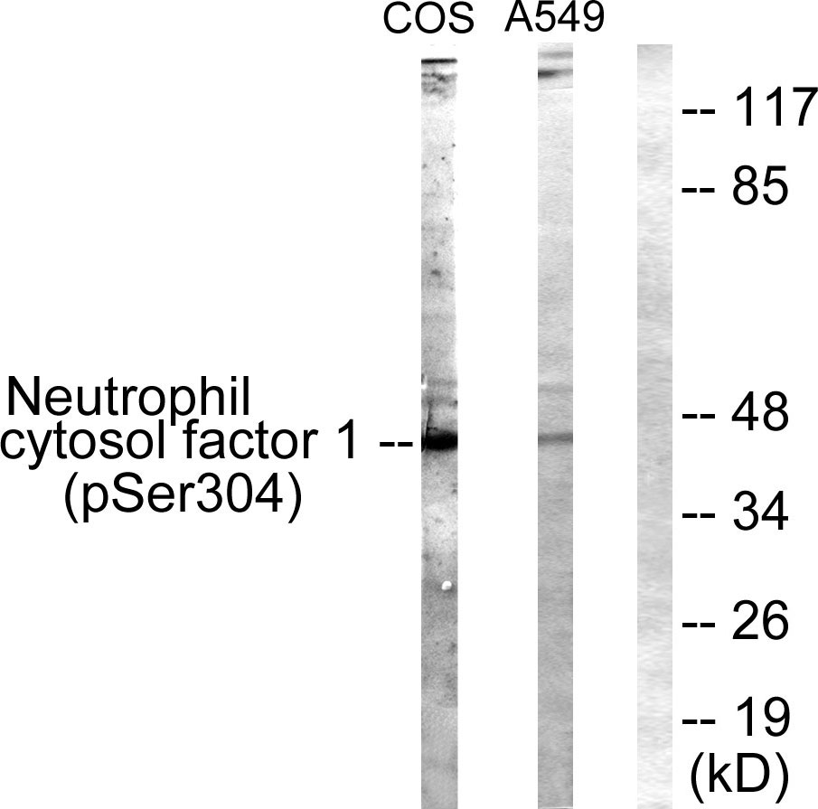Anti-Neutrophil Cytosol Factor 1 (phospho Ser304) Antibody