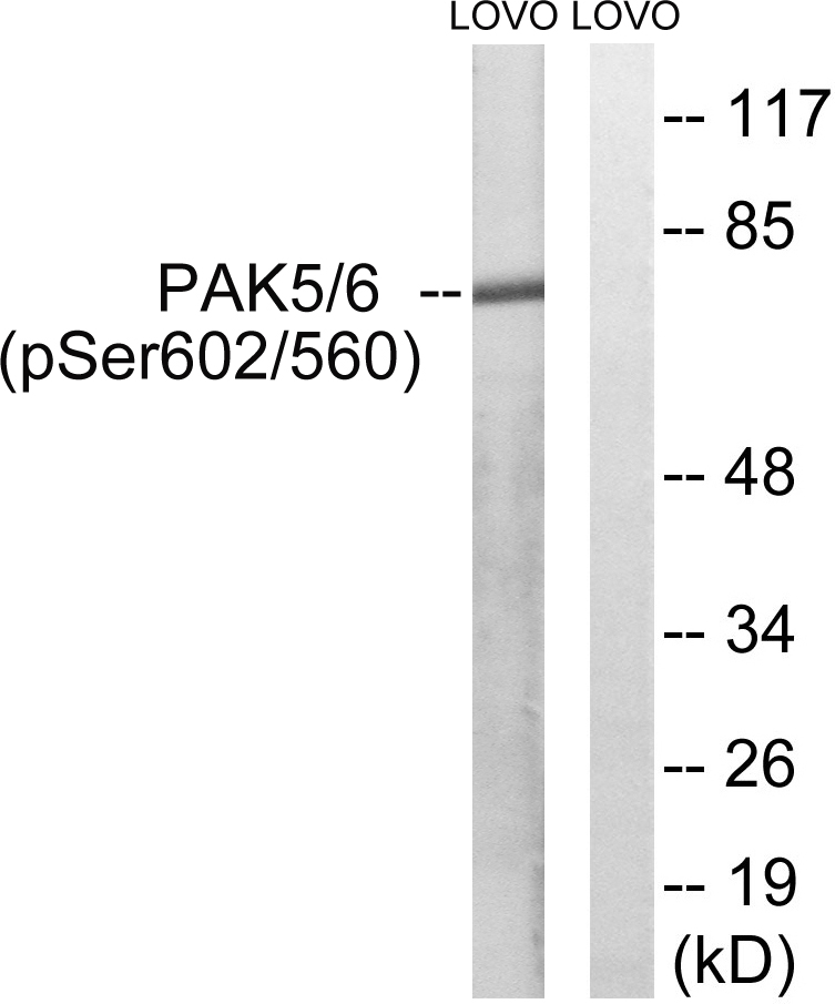Anti-PAK5 + PAK6 (phospho Ser602 + Ser560) Antibody