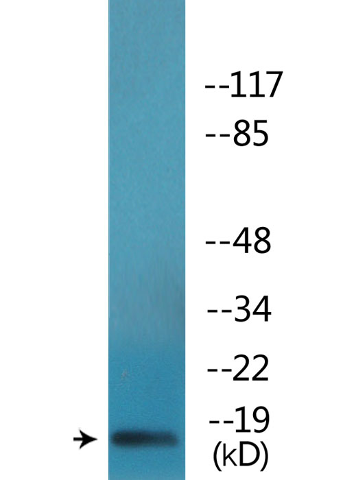 Anti-Synuclein-alpha (phospho Tyr136) Antibody Anti-Synuclein-alpha (phospho Tyr136) Antibody