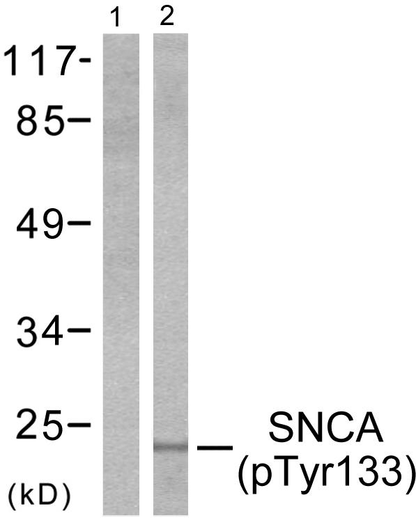 Anti-Synuclein-alpha (phospho Tyr133) Antibody