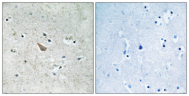 Anti-Ephrin B1 + B2 (phospho Tyr329) Antibody