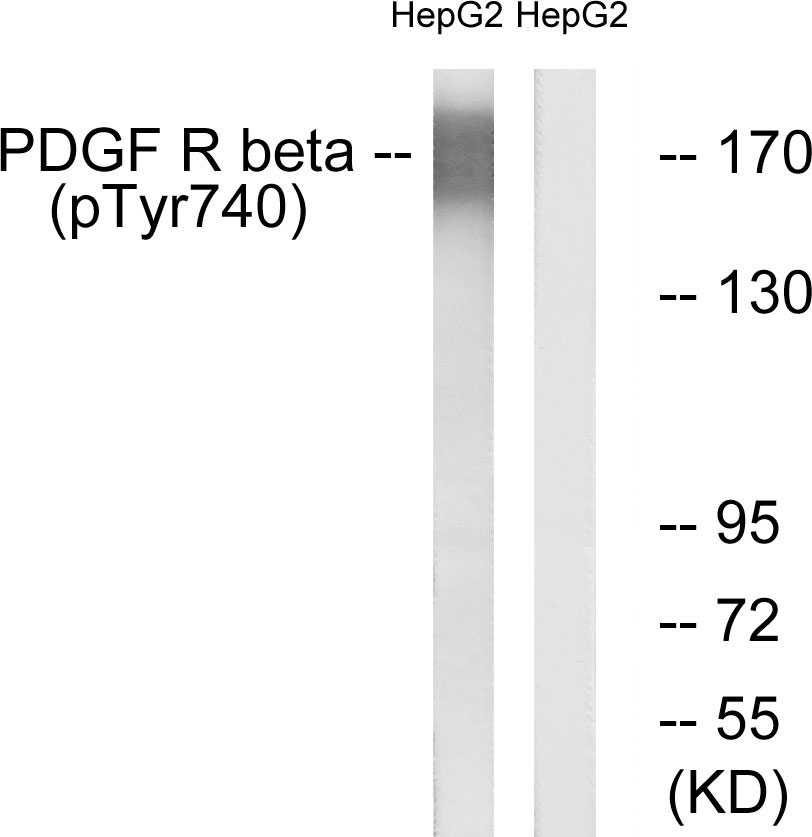 Anti-PDGFR beta (phospho Tyr740) Antibody