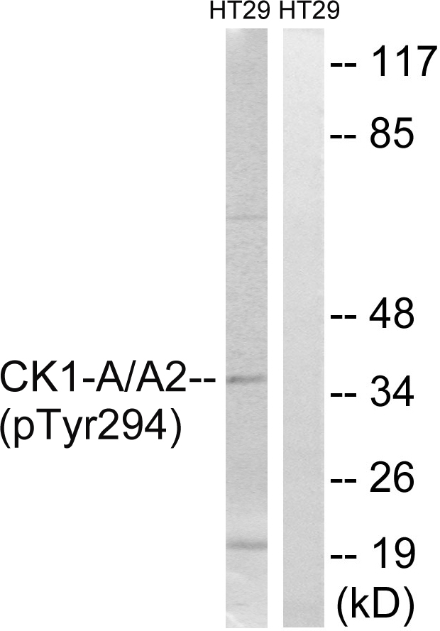 Anti-CK-1 alpha (phospho Tyr294) Antibody