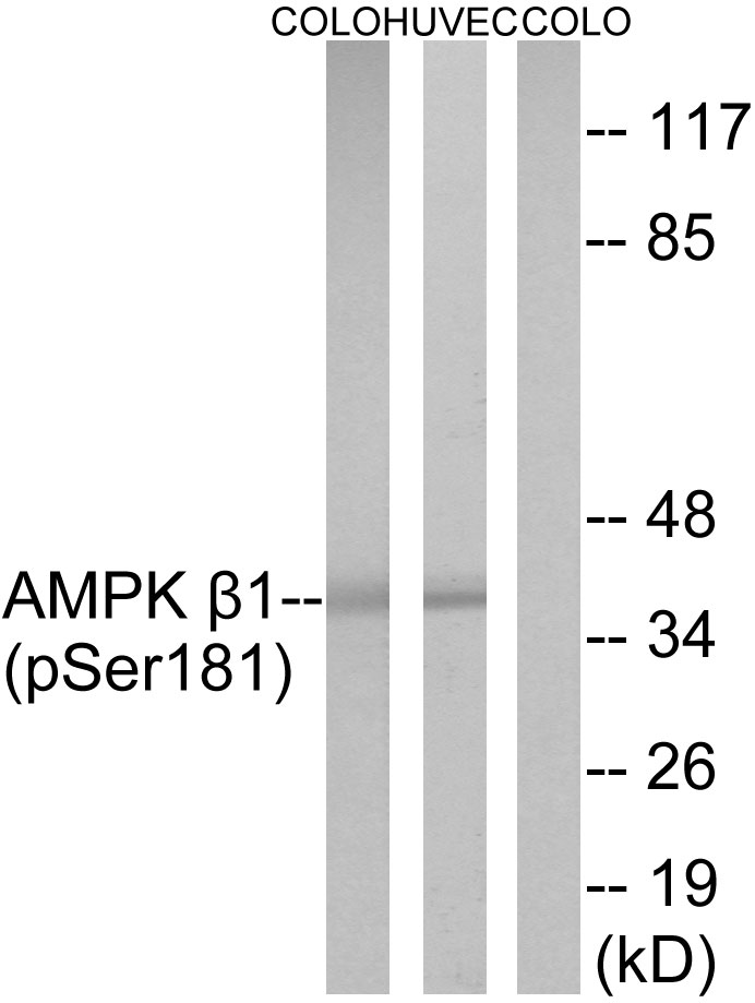Anti-AMPK beta1 (phospho Ser181) Antibody
