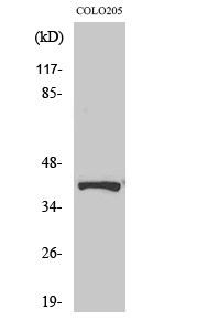 Anti-AMPK beta1 (phospho Ser181) Antibody Anti-AMPK beta1 (phospho Ser181) Antibody