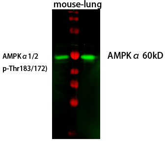 Anti-AMPK alpha (phospho Thr172) Antibody Anti-AMPK alpha (phospho Thr172) Antibody
