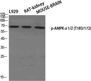 Anti-AMPK alpha (phospho Thr172) Antibody Anti-AMPK alpha (phospho Thr172) Antibody