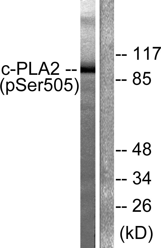 Anti-c-PLA2 (phospho Ser505) Antibody - Identical to Abcam (ab53105)