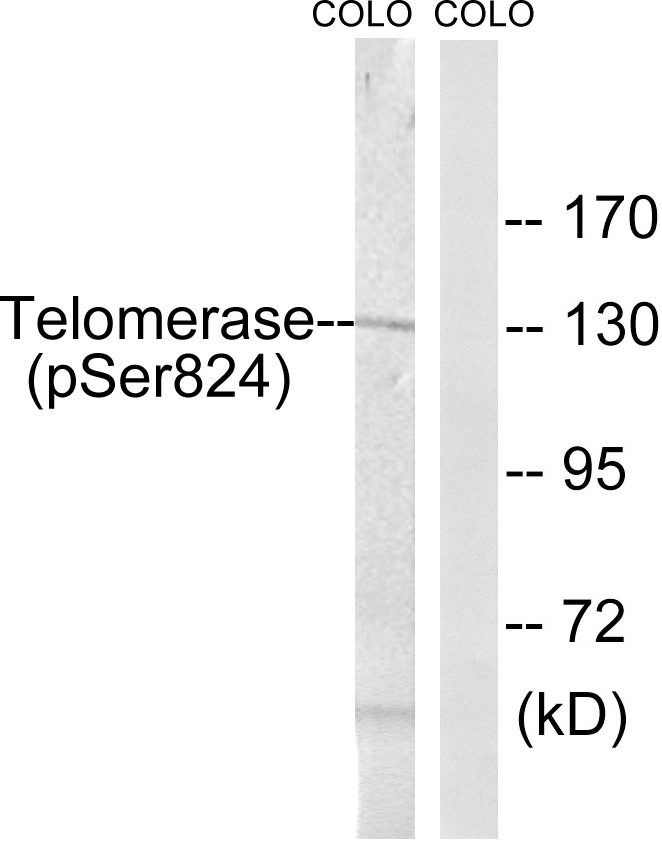Anti-Telomerase (phospho Ser824) Antibody
