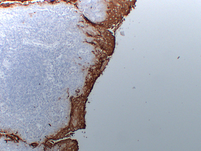 Anti-Carcinoembryonic Antigen Antibody [ABT-CEA]