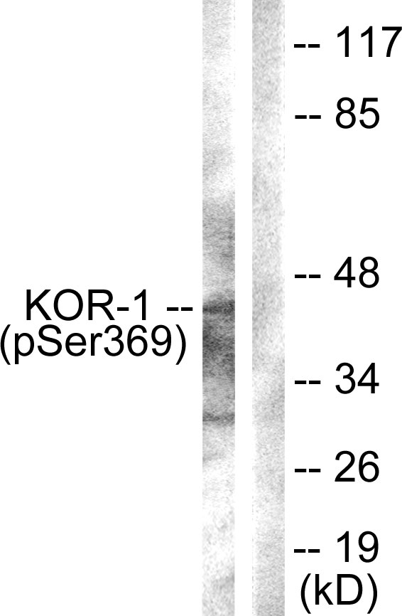 Anti-KOR-1 (phospho Ser369) Antibody