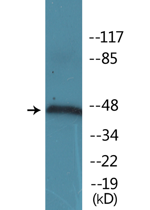 Anti-IRF-3 (phospho Ser385) Antibody Anti-IRF-3 (phospho Ser385) Antibody
