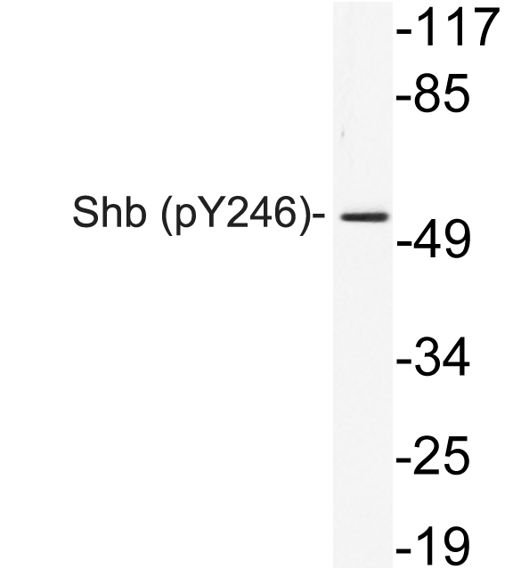 Anti-Shb (phospho Tyr246) Antibody