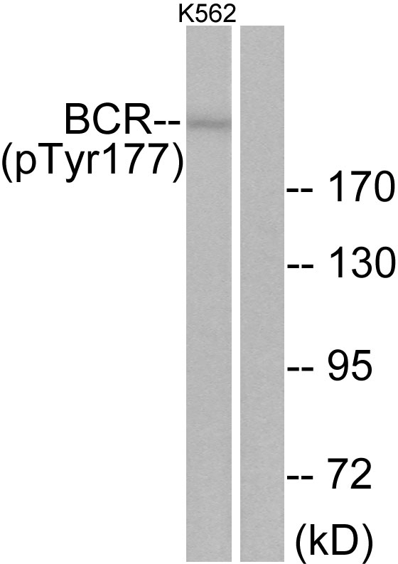 Anti-Bcr (phospho Tyr177) Antibody