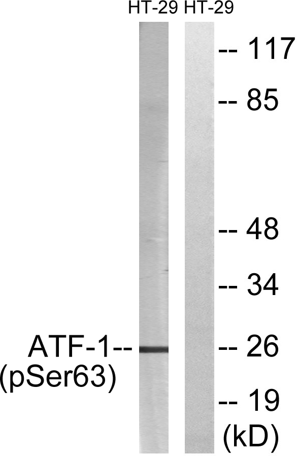 Anti-ATF1 (phospho Ser63) Antibody