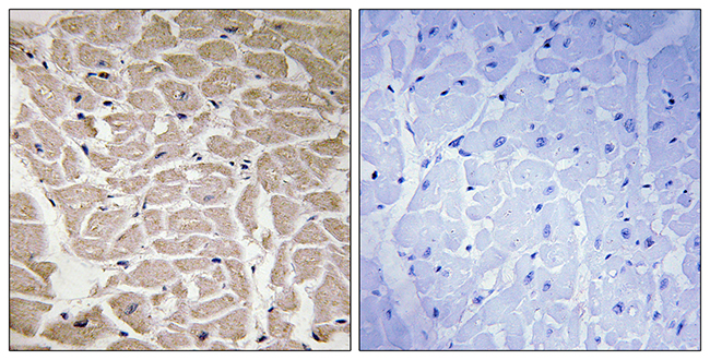 Anti-Collagen XVI alpha1 Antibody