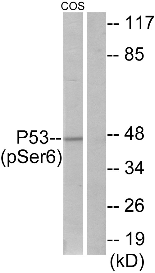 Anti-p53 (phospho Ser6) Antibody