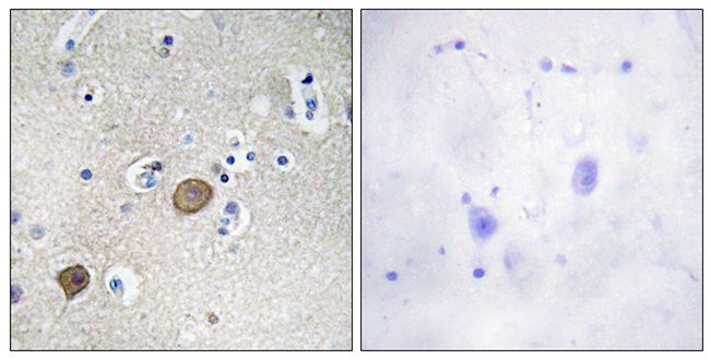 Anti-Catenin-alpha1 Antibody