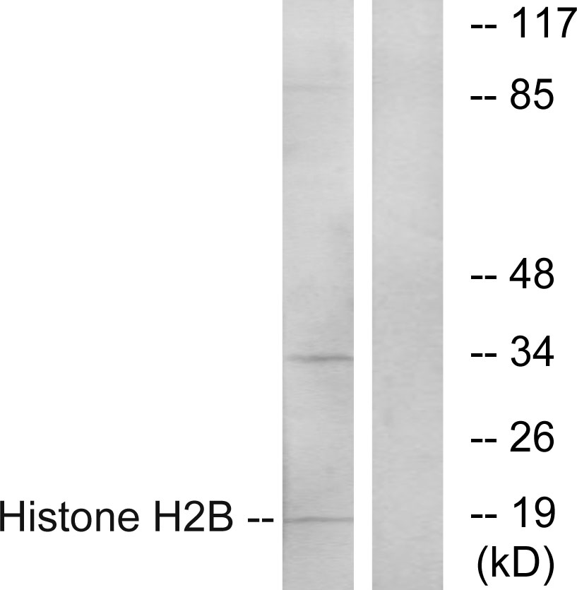Anti-Histone H2B Antibody