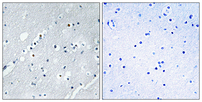 Anti-Histone H2B Antibody Anti-Histone H2B Antibody