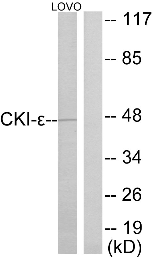 Anti-CKI-epsilon Antibody - Identical to Abcam (ab133713)