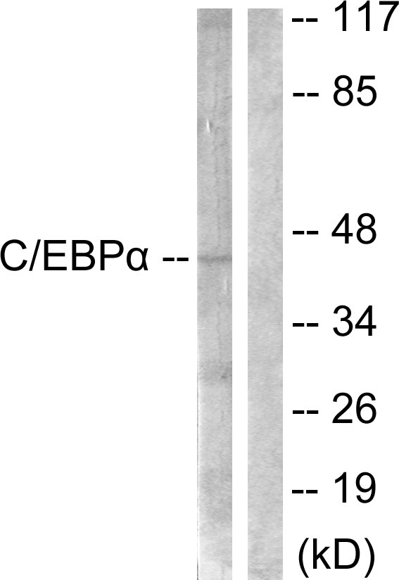 Anti-CEBP alpha Antibody Anti-CEBP alpha Antibody