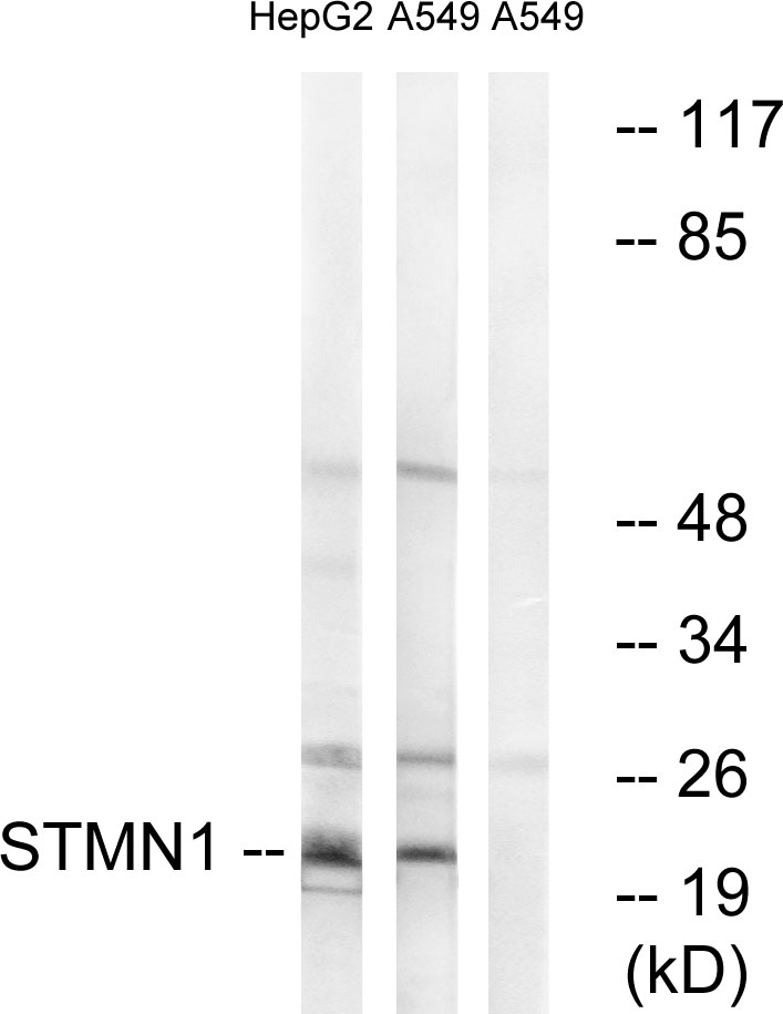 Anti-Stathmin 1 Antibody