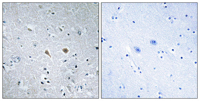 Anti-Stathmin 1 Antibody Anti-Stathmin 1 Antibody