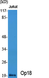 Anti-Stathmin 1 Antibody Anti-Stathmin 1 Antibody