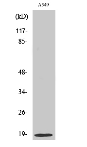 Anti-Stathmin 1 Antibody Anti-Stathmin 1 Antibody
