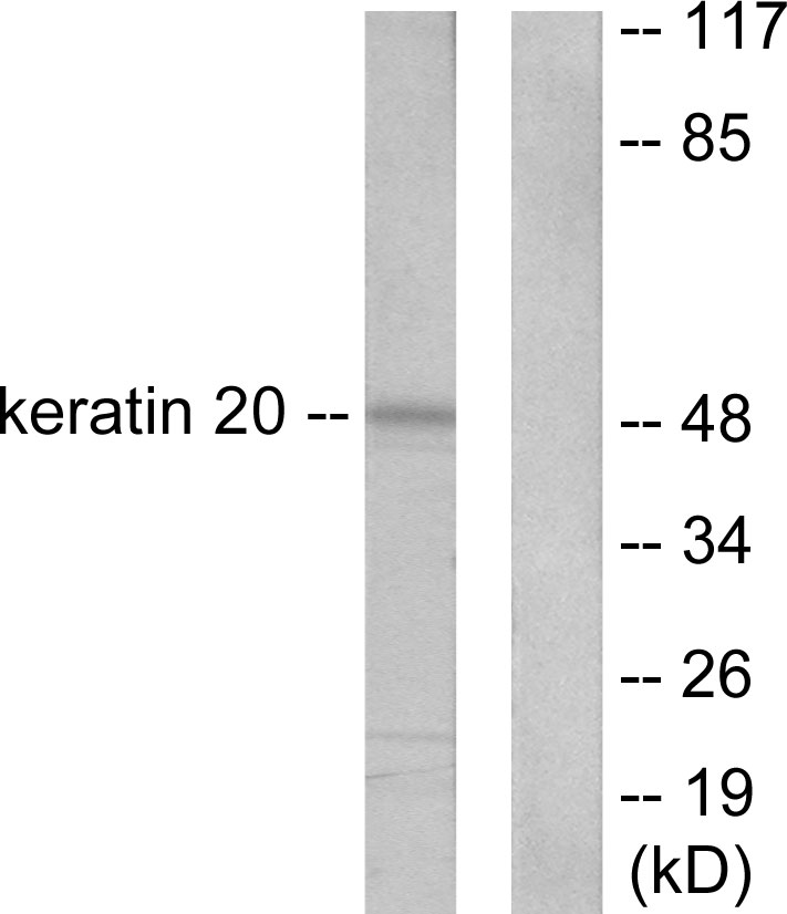 Anti-Keratin 20 Antibody
