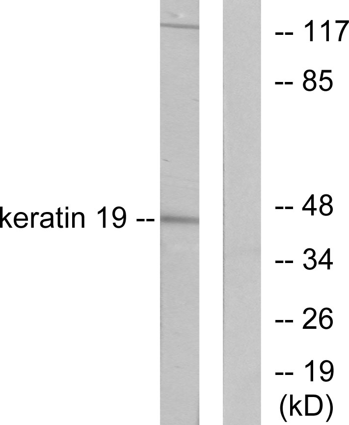Anti-Keratin 19 Antibody