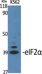 Anti-eIF2 alpha Antibody Anti-eIF2 alpha Antibody